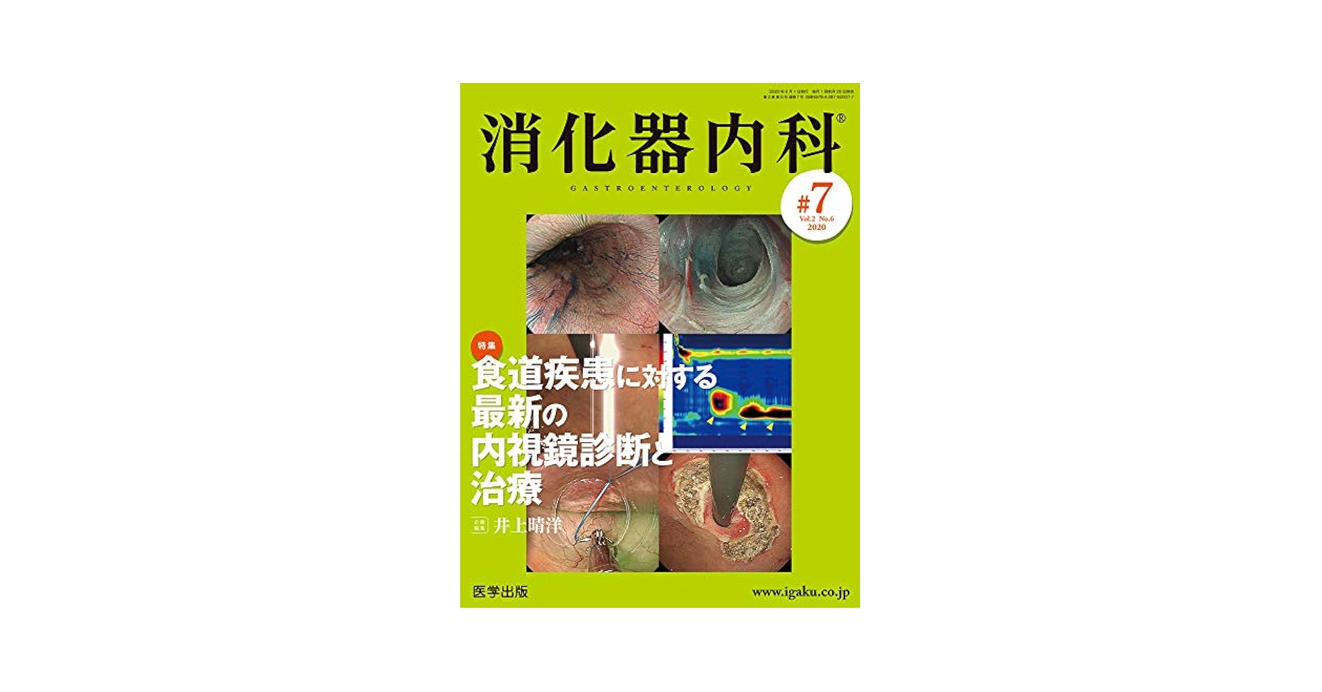 消化器内科 第7号(Vol.2 No.6,2020)特集:食道疾患に対する最新の